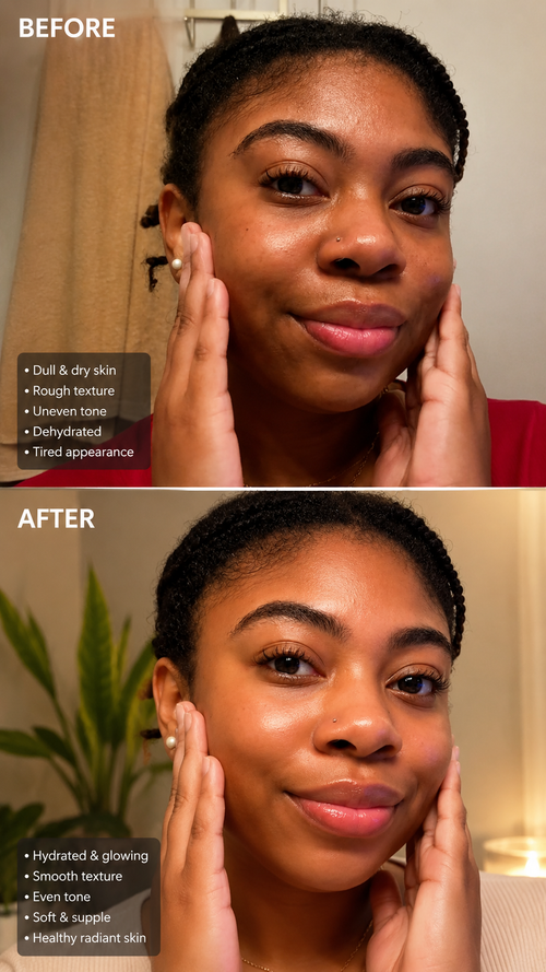 Kojic Acid & Turmeric Soap